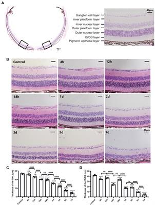 Decitabine improves MMS-induced retinal photoreceptor cell damage by targeting DNMT3A and DNMT3B